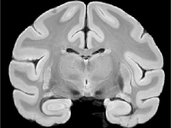 Bonnet Macaque High-Resolution Anatomical MRI