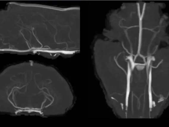 Ferret TOF Angiography