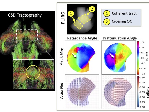 Polarized Light Imaging Validation of DTI 