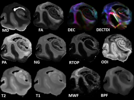 MultiMicrostructuralMaps Human Temporal Lobe