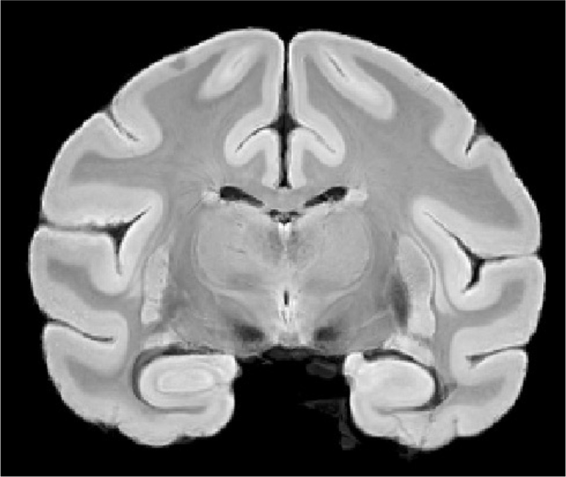 Bonnet Macaque High-Resolution Anatomical MRI
