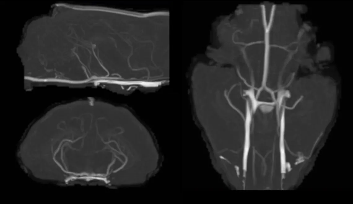 Ferret TOF Angiography