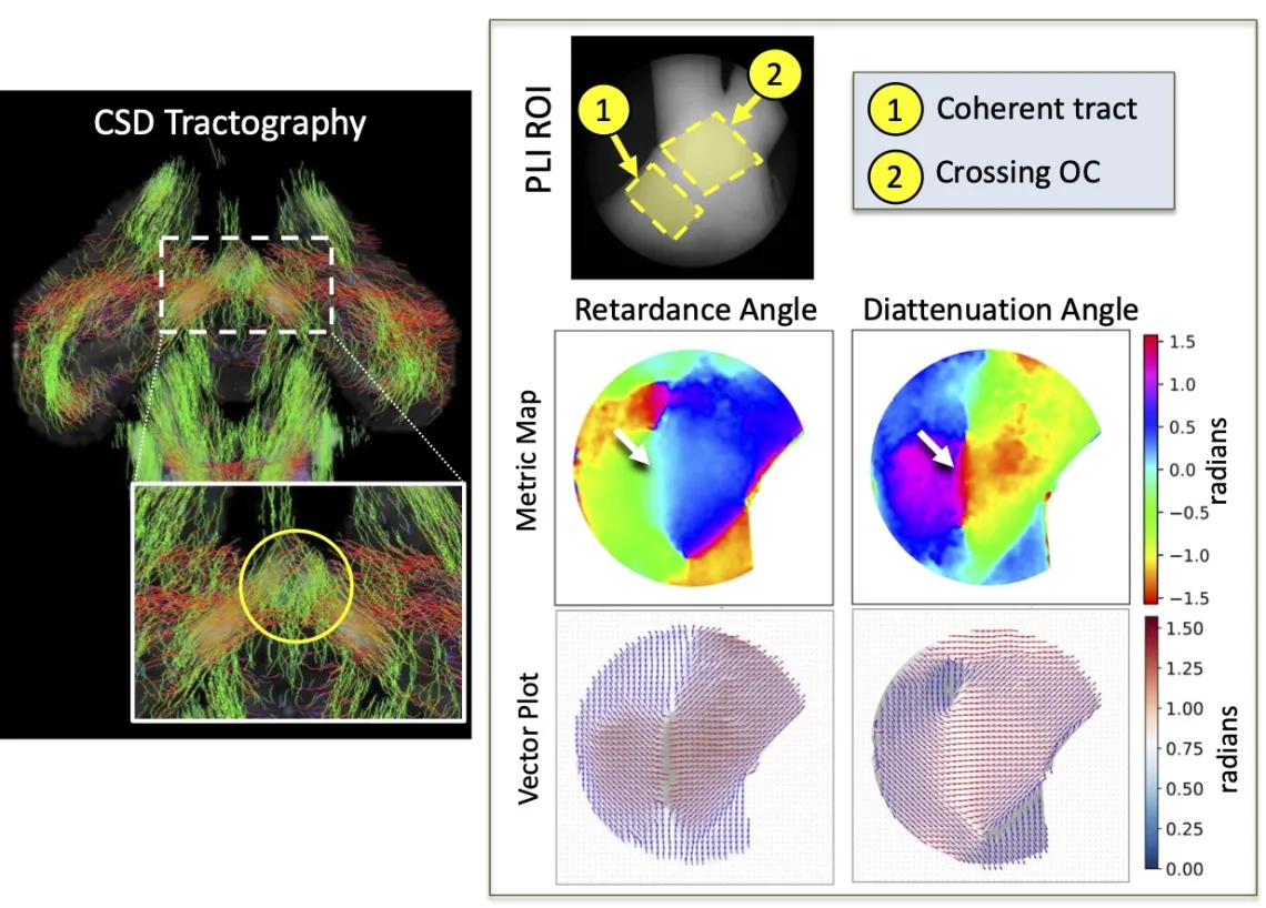 Polarized Light Imaging Validation of DTI 