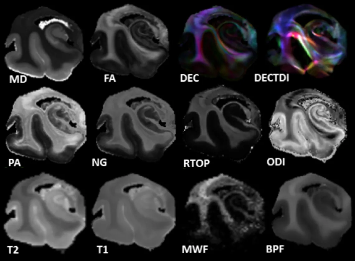 MultiMicrostructuralMaps Human Temporal Lobe